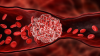 თრომბები