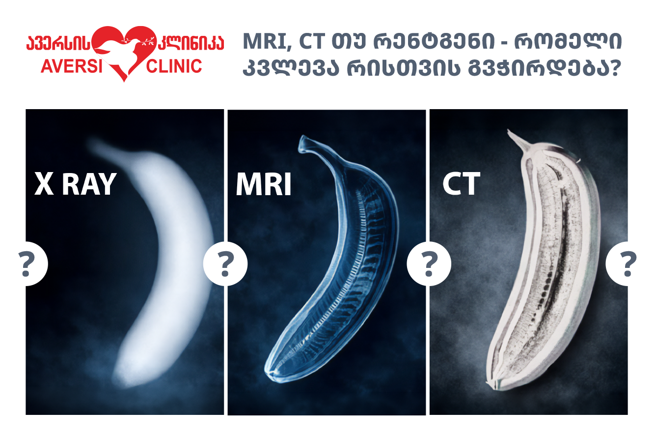 MRI, CT თუ რენტგენი - რომელი კვლევა რისთვის გვჭირდება ?